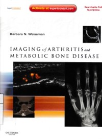 Imaging Of Arthritis And Metabolic Bone Disease