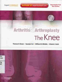 Arthritis & Arthroplasty : The Knee